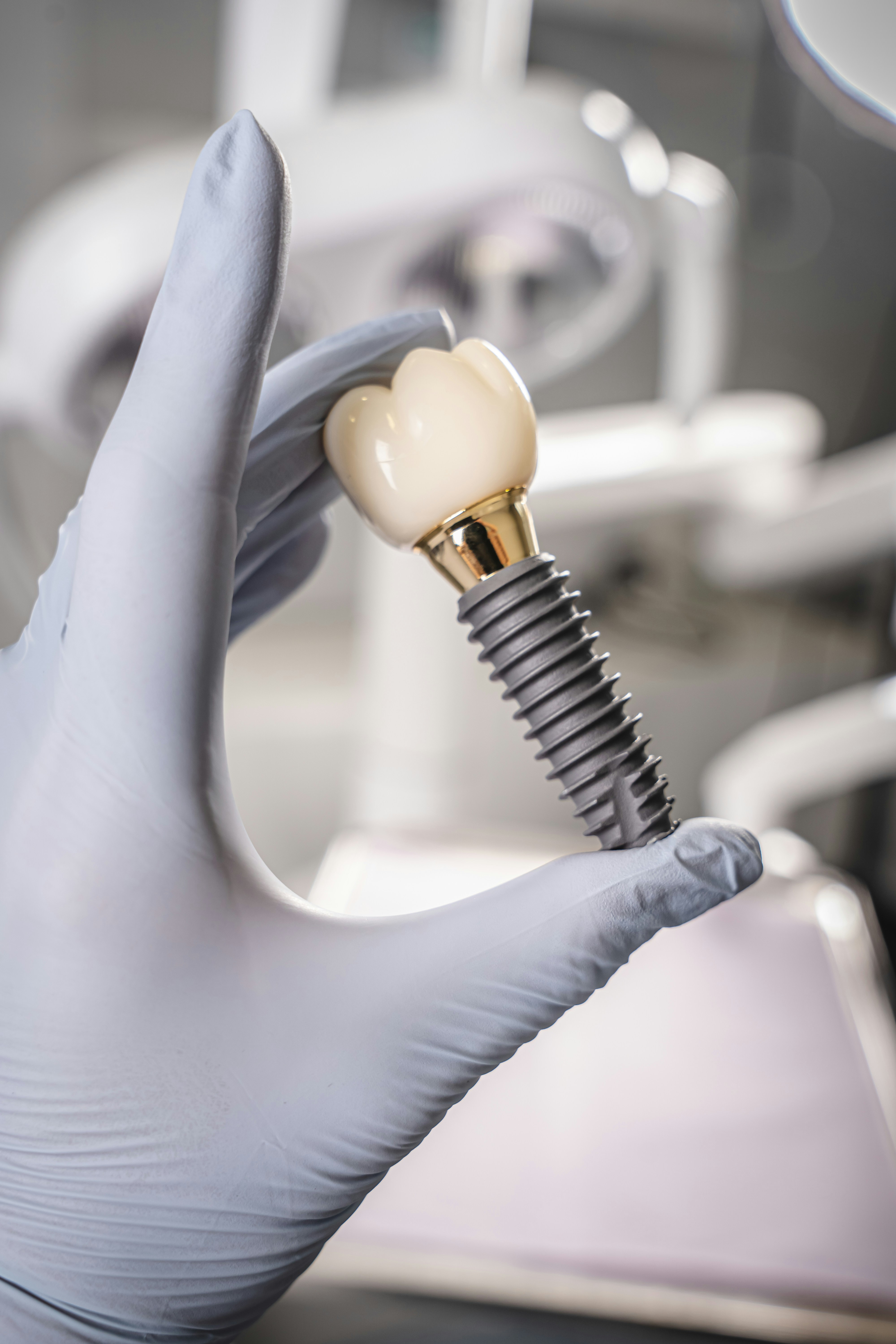Dental Implants