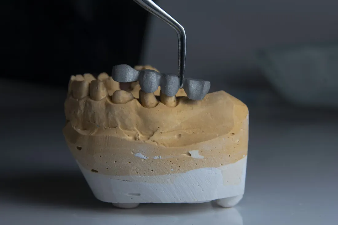 Prostodoncia - Hospital Dental de la Universidad Biruni
